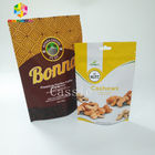 Gıda Snack Bag Ambalaj Fermuar / Euro 500g Fıstık Çerez Paketleme için Delik